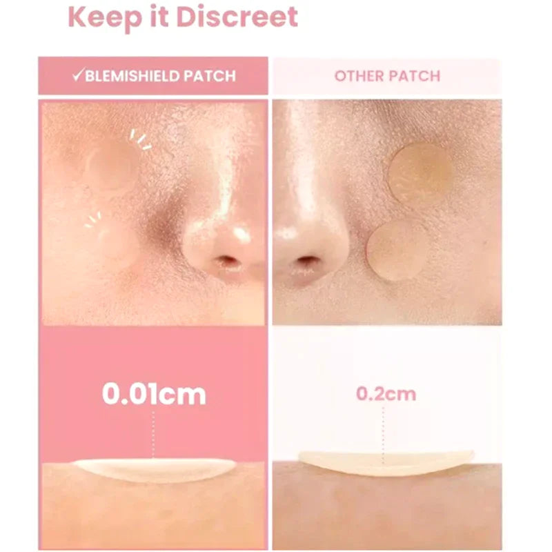 360pcs Invisible Heart Star Face Skin Care Acne Pimple Patch Professional Healing